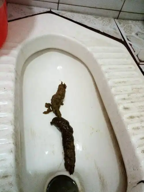 大便黑色怎么办? 先是黑色,后面又带黄色,是什么原因?