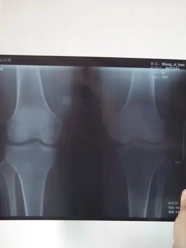 照了双膝片,诊断得:双膝诸骨骺板已闭合.请问还能长高吗