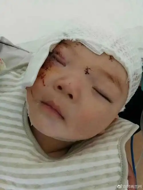 甘肃省人民医院小儿外科8个月大的婴儿急需爱心接力心话筒