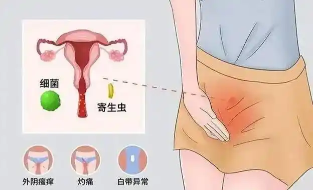 北京劲松医院性疾病防治中心阐述阴虱带给女性的几点危害