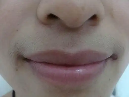 在长沙雅美脱唇毛微笑告别男人婆