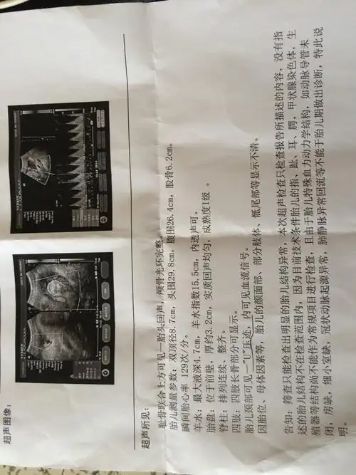 分钟前 医生来自冠县人民医院 答: 超声报告显示胎儿颈部u型压迹