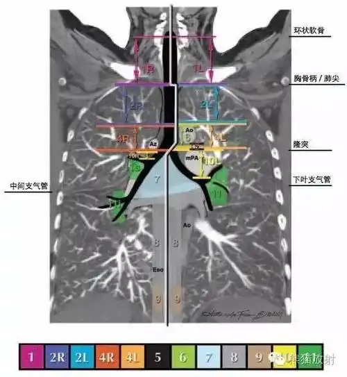 今日分享 — 纵隔淋巴结分区图谱