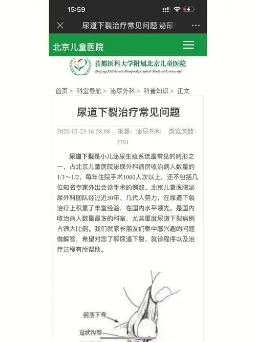 北京儿童医院尿道下裂科普1