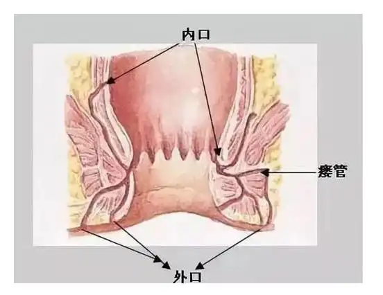 贵阳东大肛肠医院不看后悔出现这些情况肛瘘已经悄悄入侵肛门了
