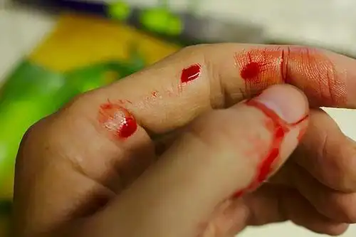 【梦见别人满身血】