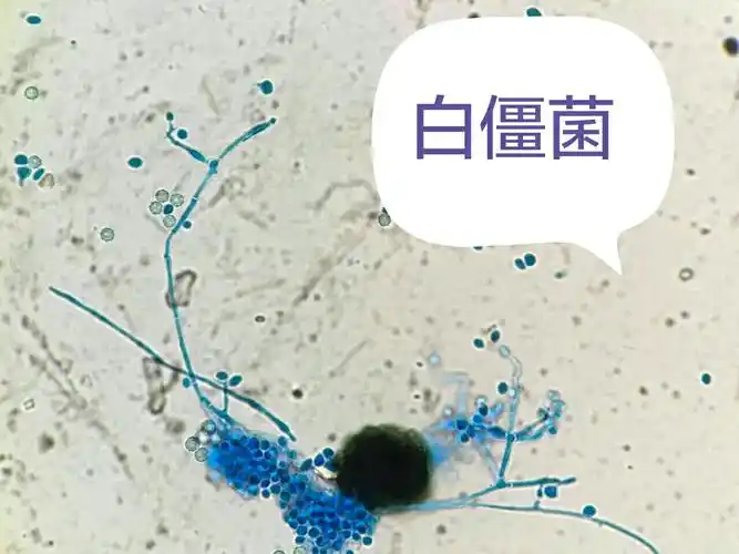 大讲堂真菌图片小札(一)