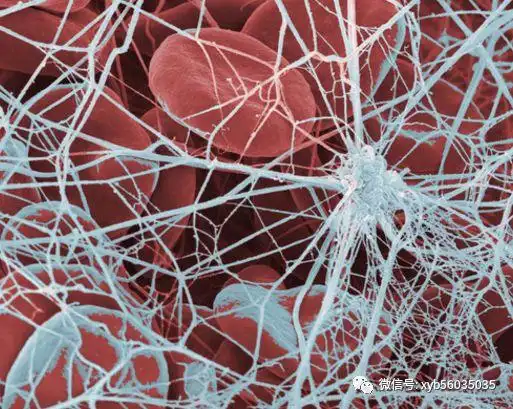 什么是骨髓?一个包含千万细胞的人体重要组成部分!