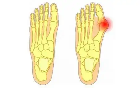 脚疼的各个部位详细图 - 搜狗图片搜索
