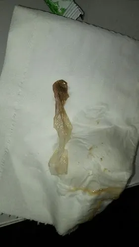 都满月四五十天了,下面突然掉出来个类似鸡蛋膜一样的东西,不知