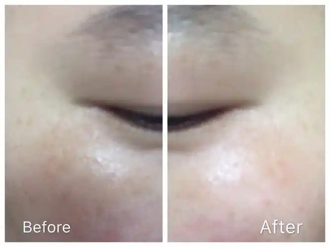 雅诗兰黛小棕瓶精华,红石榴晚霜,科颜氏美白淡斑精华