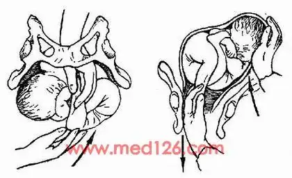 p>胎儿横卧于 a href="#" data-lemmaid="17007">子宫 /a>内约占 a