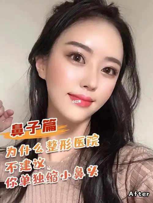 为什么整形医院不建议你单独缩小鼻头7571