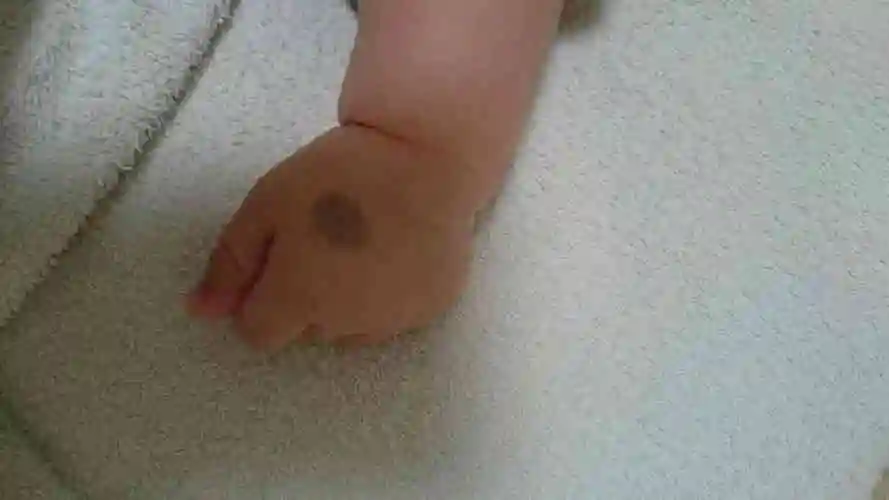 都说菩萨送的孩子带胎记要是长在屁股上有哪些寓意