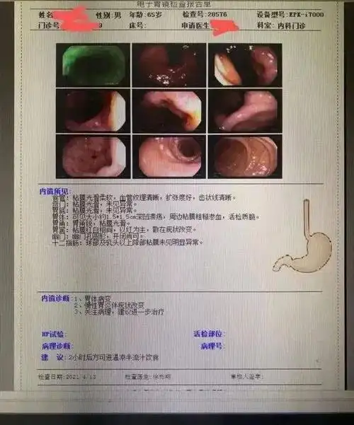 案例小小胃溃疡半年变胃癌