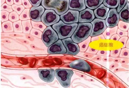 自切肿瘤之后……_参考网