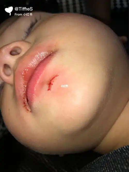 流了一嘴血,外公外婆心都碎了