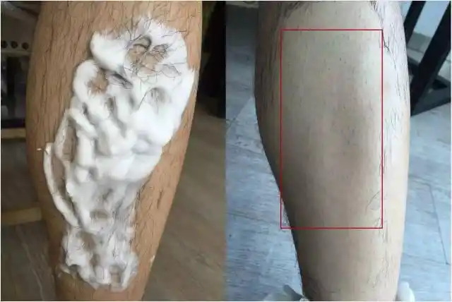 技术小哥献出一条腿 亲测几种最火的脱毛大法