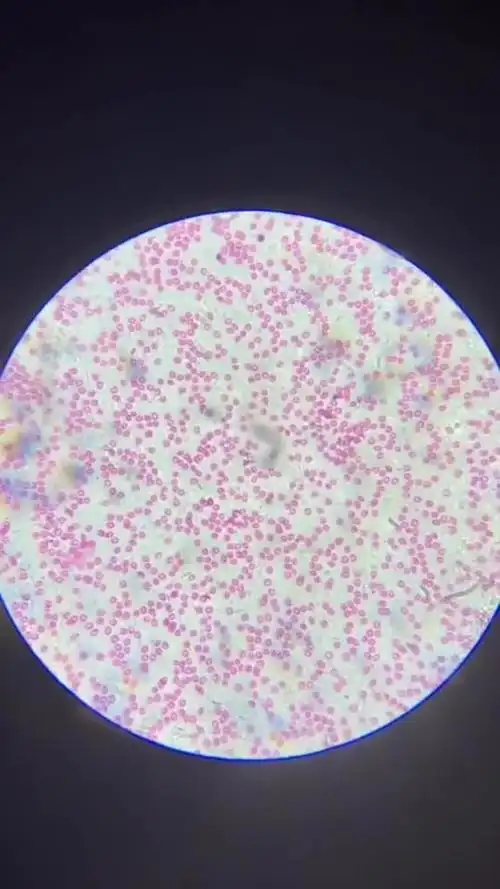 血液放大100倍,大家猜猜能看到什么