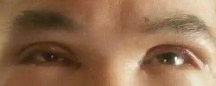 人死前眼睛的变化瞳孔会放大角膜会变这样