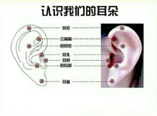 "关爱耳朵 从我做起"——阜安办事处胜利幼儿园小班