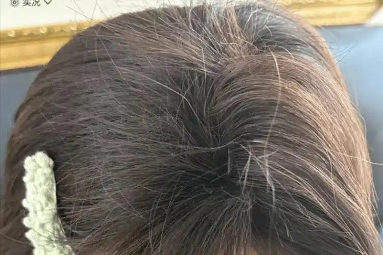 发质干枯,掉发巨多?用胱氨酸 一物,养出瀑布绸缎秀发!_压力_方法_按摩