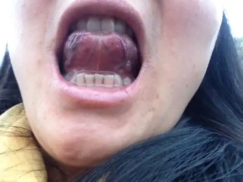 请医生我的舌脉有什么问题吗?