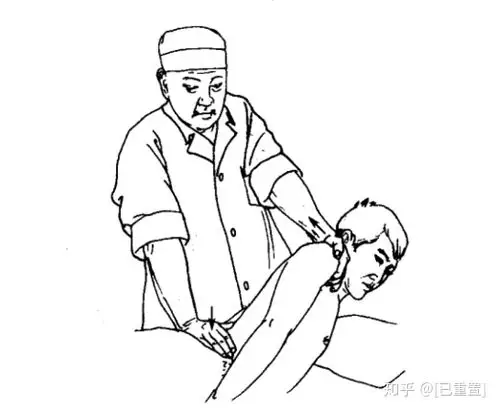 2,牵引肘推正法多用于腰椎棘突偏歪较难整复者.