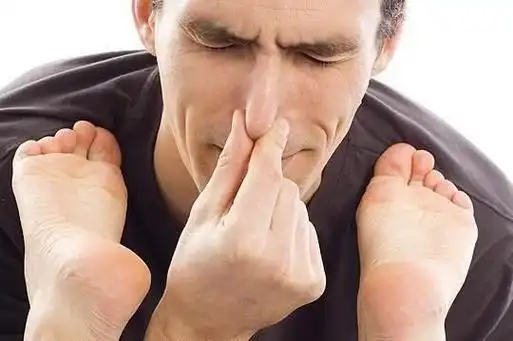 脚出汗怎么办(脚老是出汗臭怎么办)-点子猫