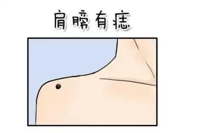 肩膀上有痣代表什么,肩膀痣相详解
