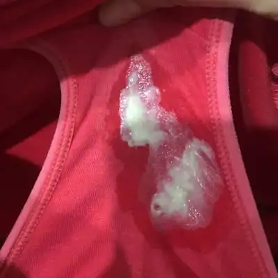 前几天做了白带常规清洁度是二