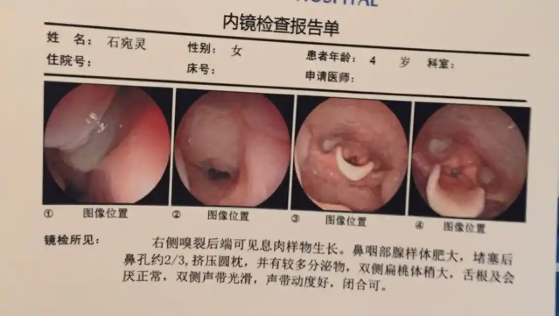 00 元,快来一起免费围观~  单老师您好,我是您的粉丝,我女儿有鼻息肉