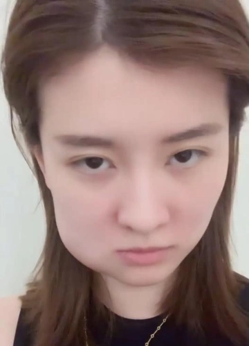 乔欣拔智齿后,自嘲脸肿得像个仓鼠!网友:莫名的喜感!