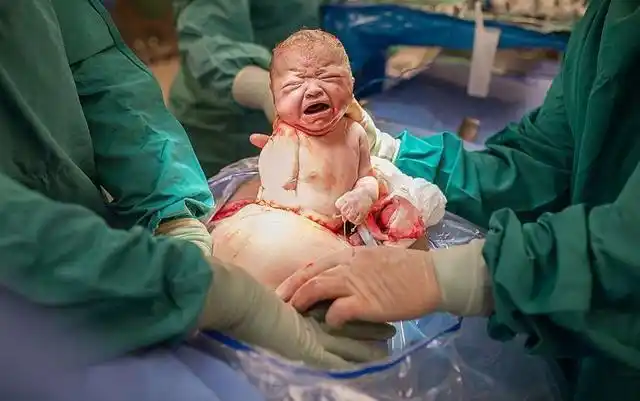 原创孕妈生孩子真实画面,小婴儿顺利"破茧而出",画面震撼又感动