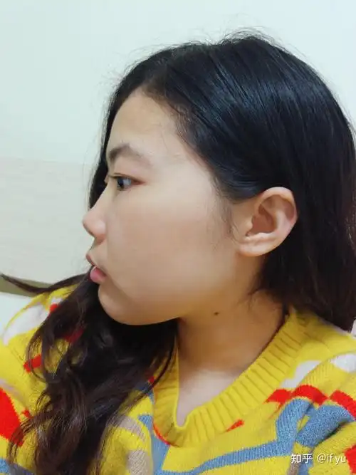 正脸好看但侧脸丑到爆是种怎样的体验