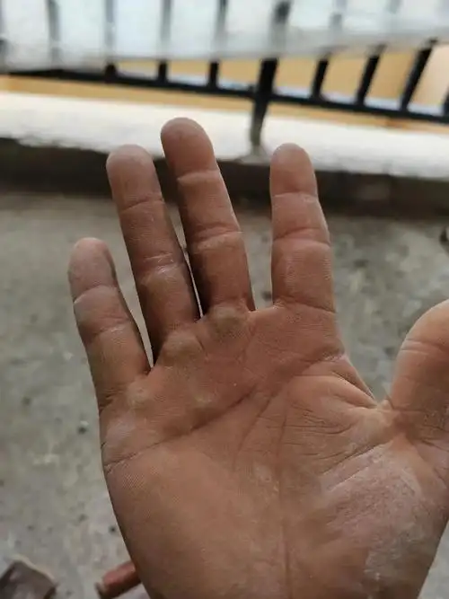 这是30 2的手#90后的我们 #干活的手 #不认命就拼命 - 抖音