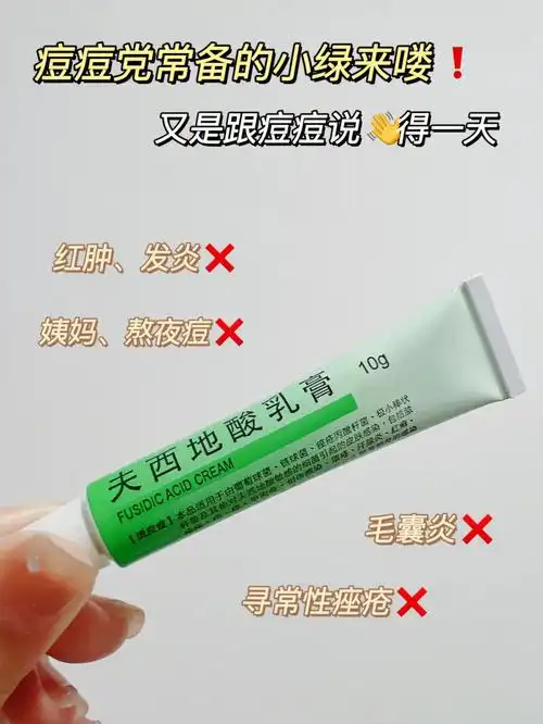 7115给推荐了这款奥络夫西地酸乳膏,是一款香港制造的祛痘药膏,线
