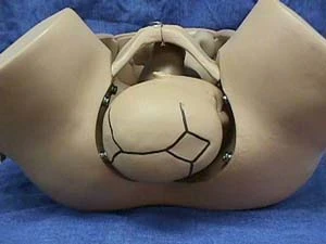 右枕横位: 枕先露时,胎儿的枕骨靠骨盆右侧枕骨横在骨盆上.