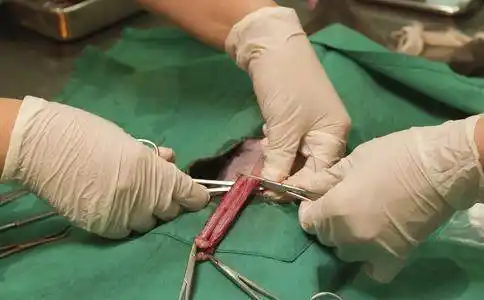 v男性行输精管结扎与"太监"将睾丸"阉割"是两回根本不同的事.