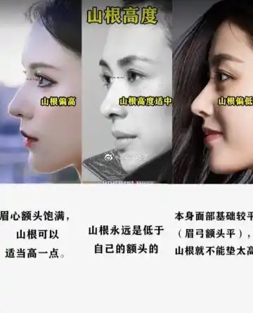 给人一种小巧清新的自然感觉; 2,韩式小翘鼻特点:鼻梁高鼻尖上翘s型