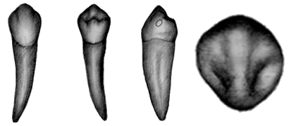 【例题】下颌双尖牙与上颌双尖牙区别中哪一点错误
