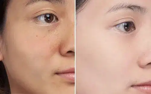 有没有发现 身边真正皮肤黑的女生 并没有多少 而且即使肤色黑,但是