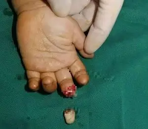 兔子急了也咬人