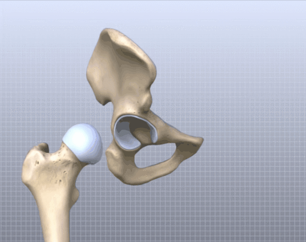 【常见疼痛】第八期 | 髋关节解剖