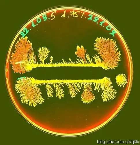 细菌菌落细菌菌落彼此靠的很近的时候能释放出有毒物质,并在它们之间
