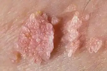 健闻登顶计划##微博健康公开课