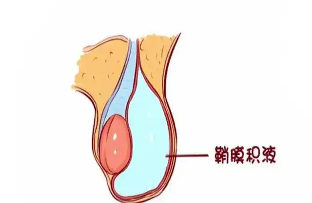 3岁宝宝蛋蛋一大一小送医院检查后医生说还算比较及时