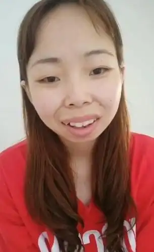 "快手嘟嘟姐"近况曝光!2年后"暴牙凸嘴"消失网友吓歪:美炸