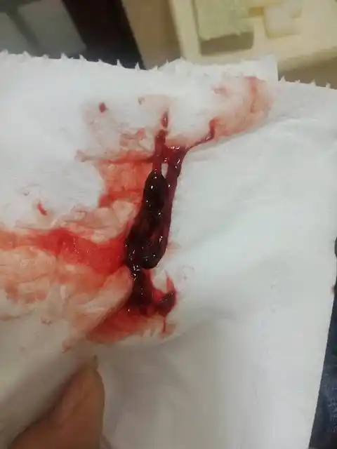 来例假第二天哗哗的流 月经是从哪里流出来的?