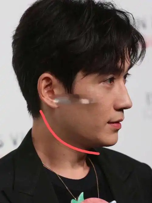 大家有没有发现,侧脸颜值除了下巴以外下颌线也特别重要?